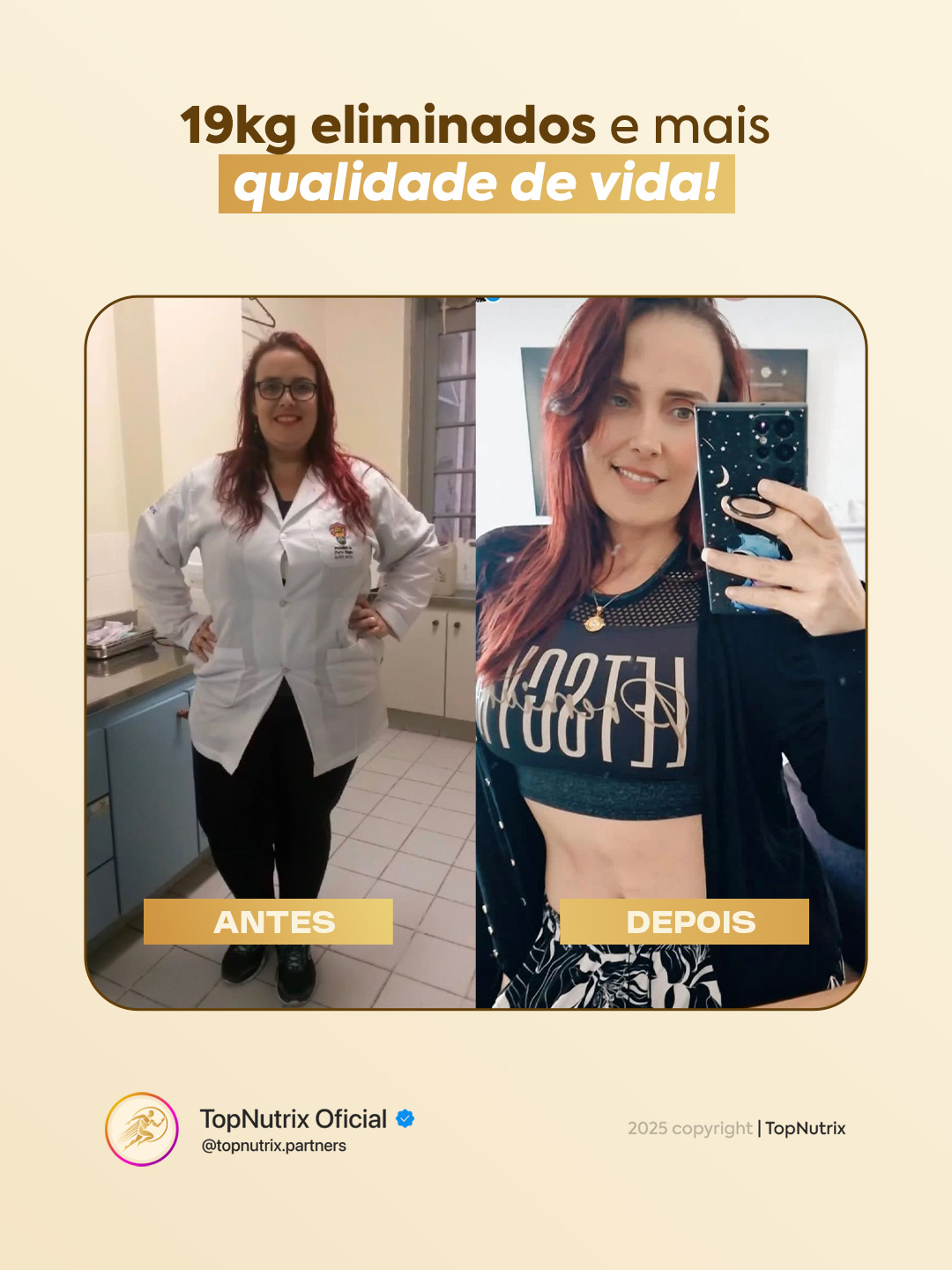 S1 Post 5 (Setembro) - (Antes x Depois)